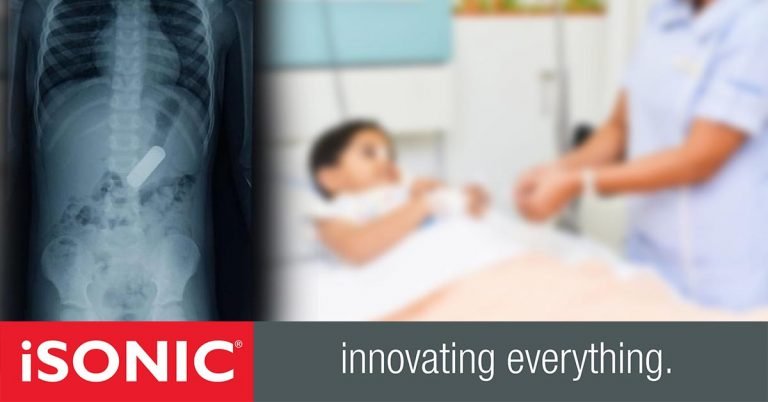 Hospital reports that cases of children swallowing chemicals and small electronic items are on the rise in the UAE.