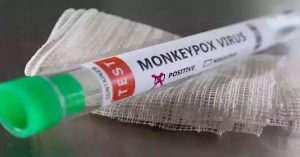 Monkey pox confirmed in Mexico- US citizen found