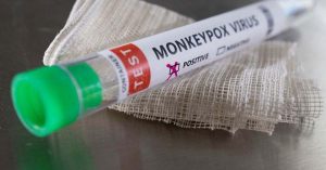 Monkey pox: Health agency confirms community outbreak in UK.