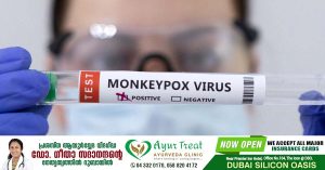 One more monkeypox in Kerala- A native of Kannur who came from Dubai was diagnosed with the disease.