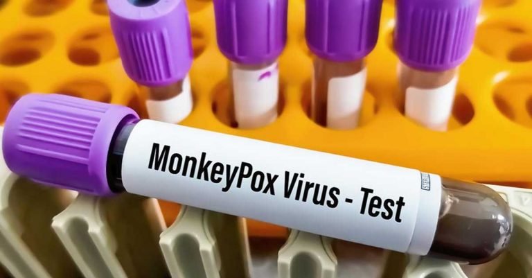 Youth confirmed to have monkeypox in Thrissur: This is India's first death from monkeypox