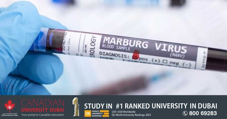 Marburg virus- Ministry warns UAE citizens not to travel to Guinea and Tanzania