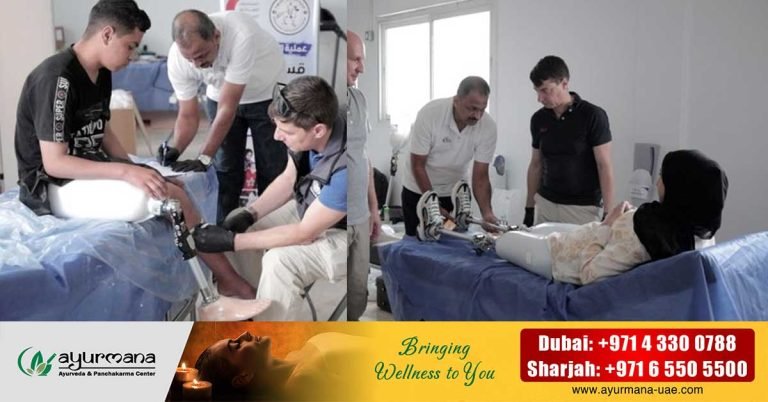 UAE's field hospital begins fitting prosthetics to Gaza war-wounded